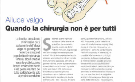 Alluce valgo – quando la chirurgia non è per tutti